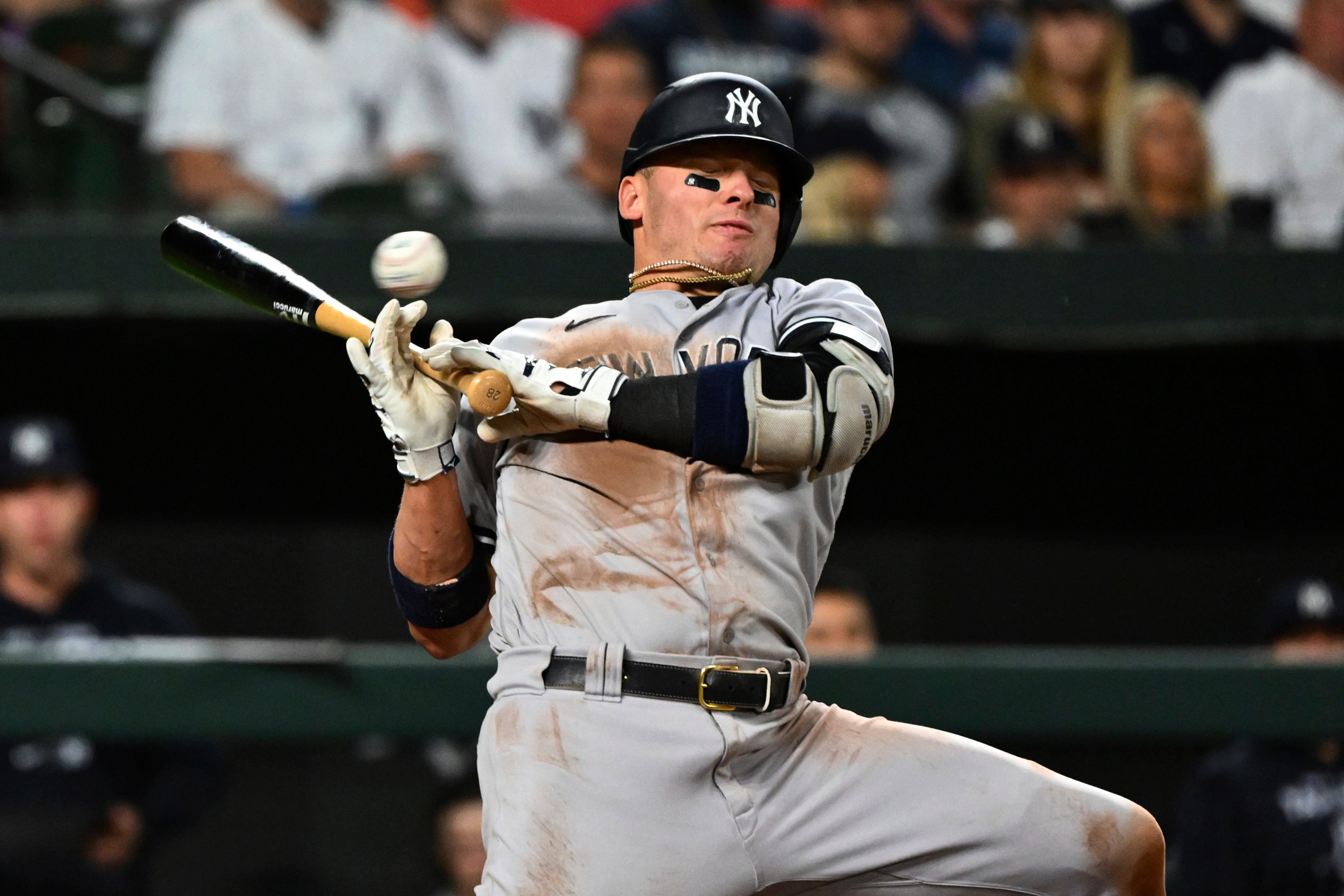 DEP-BEI YANQUIS-LESIONES