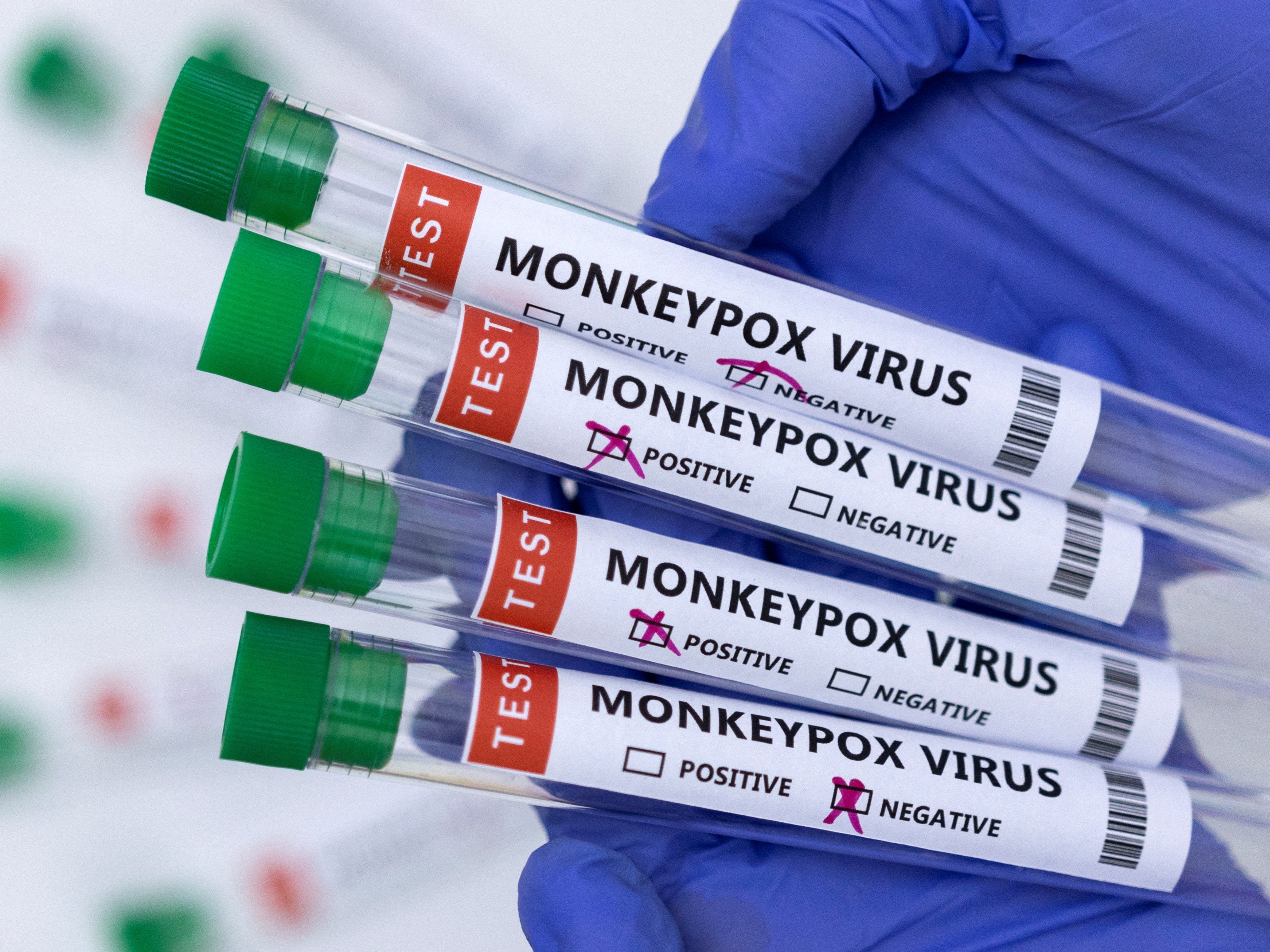 Test tubes labelled “Monkeypox virus positive and negative” are seen in this illustration taken May 23, 2022