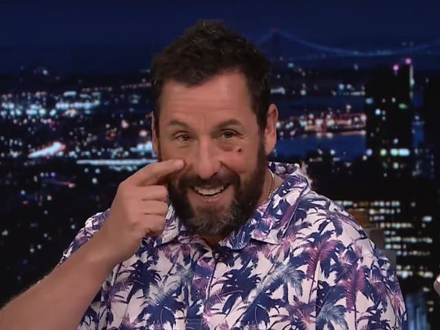 <p>Adam Sandler on ‘The Tonight Show’, sporting a black eye</p>