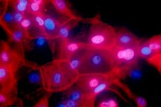 Becoming a mother after breast cancer does not harm chance of surviving illness, study finds