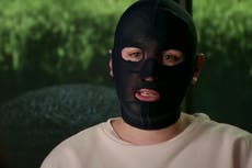 Australian woman who suffered third-degree burns from volcano eruption shows her face for first time