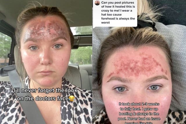 <p>“Don’t be stupid, check the expiration date on your sunscreen,” she captioned the TikTok</p>