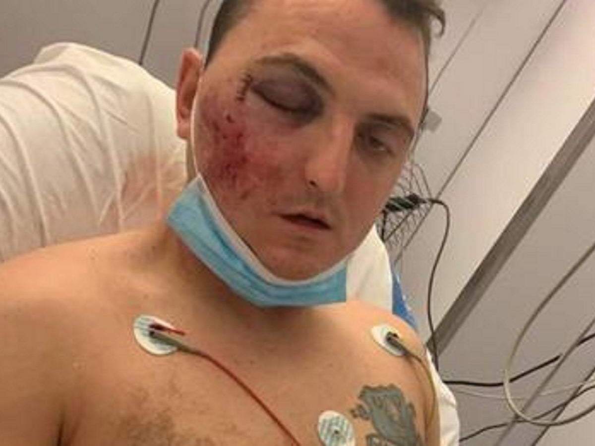 İspanya'da tatilde olan İngiliz baba 'uçurumdan atıldı' kafatasında kırık ve kırık kollardan muzdarip