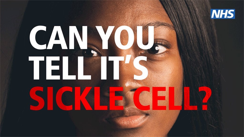 NHS England has launched a campaign to boost sickle cell awareness.