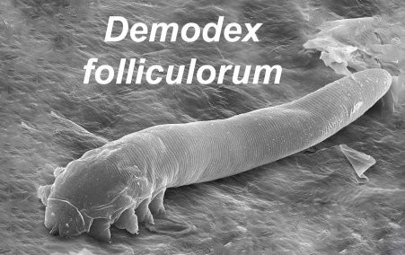 The microscopic mites are changing from external parasites to internal symbionts