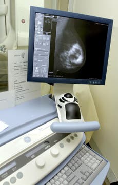 Breast cancer spreads at night, new research suggests