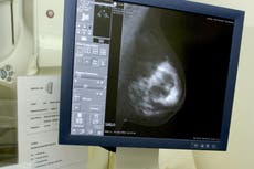 Breast cancer spreads at night, new research suggests