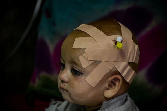 <p>An Afghan child is treated inside a hospital in the city of Sharan after getting injured in the earthquake</p>
