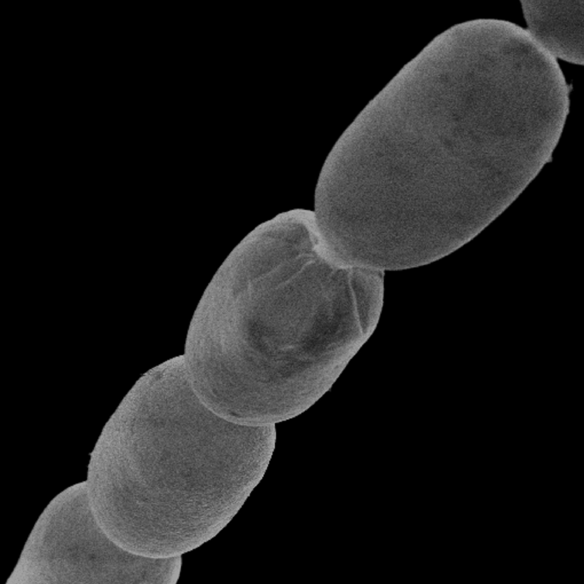 World Largest Bacterium