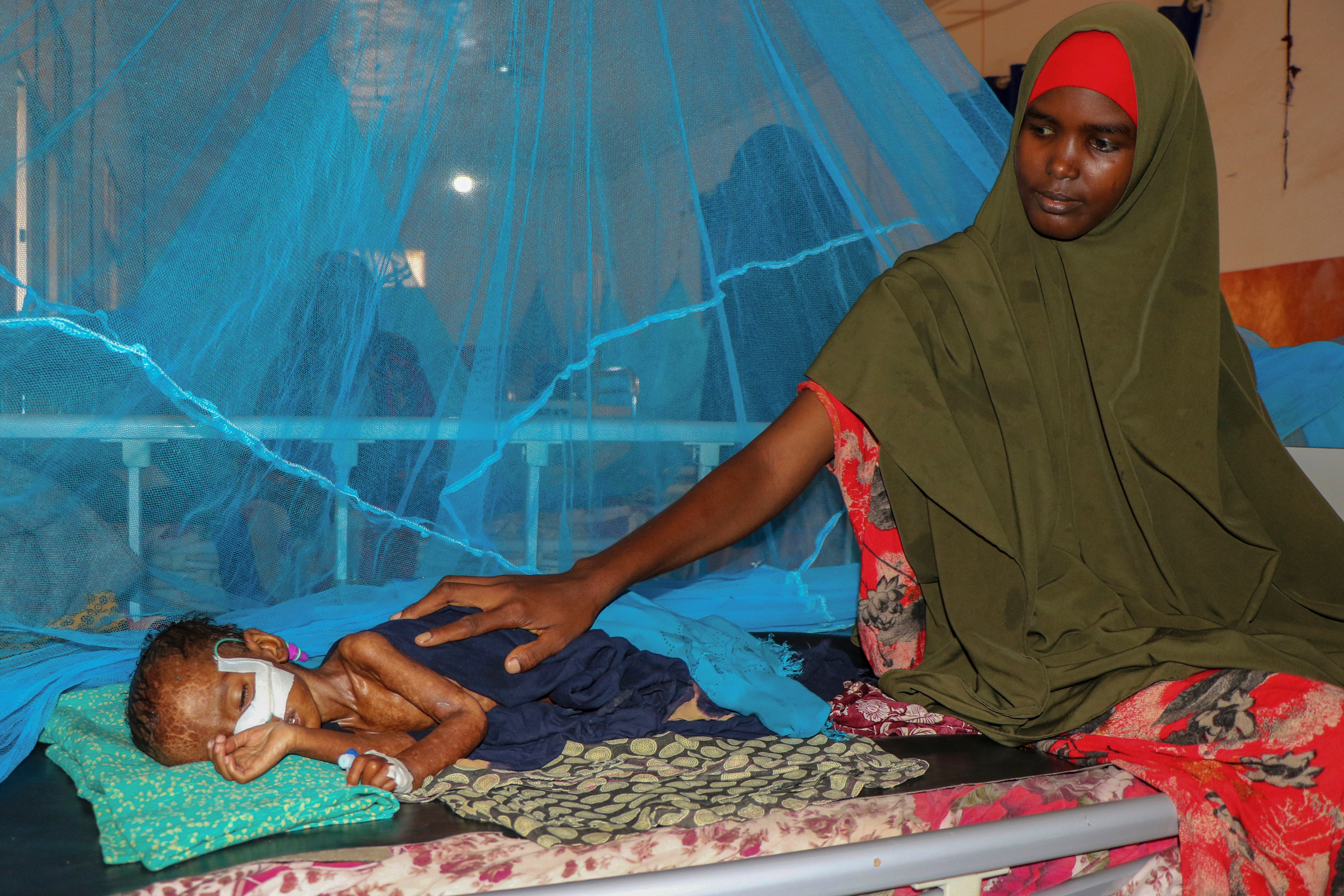 Dhahira Hassan Ali sits with her one-year-old son Adan as he is fed via a nasogastric feeding tube to treat his severe acute malnutrition, at the stabilization center of Bay Regional Hospital in Baidoa, Somalia
