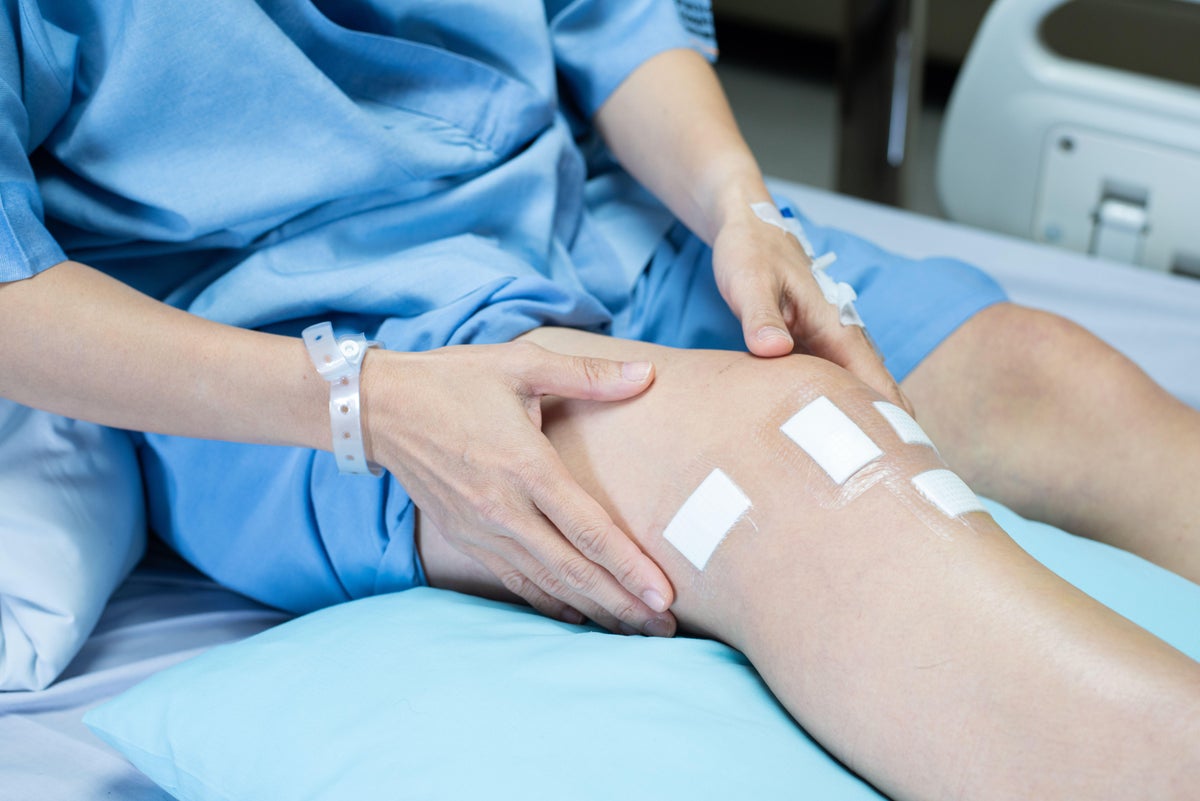 Knee ops dropped after NHS policies on patient weight introduced, study finds