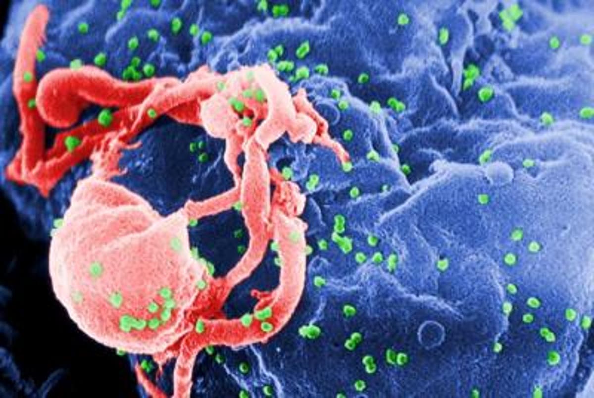 HIV infection accelerates body’s ageing process, study finds