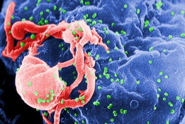 <p>This is a scanning electron micrograph of HIV-1 budding (in green) from cultured lymphocytes</p>
