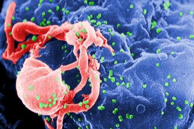 <p>This is a scanning electron micrograph of HIV-1 budding (in green) from cultured lymphocytes</p>