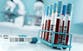 A simple blood test could offer first reliable diagnosis for ME