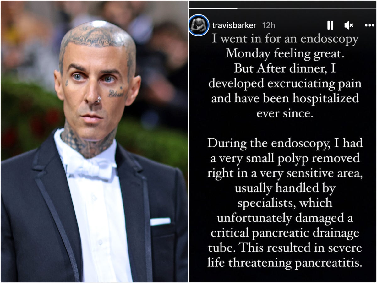 Travis Barker diagnosed with ‘life-threatening pancreatitis’ as he shares health update