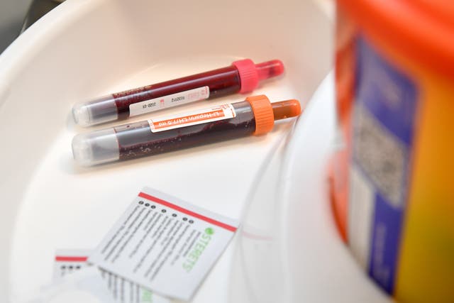 Blood tests could predict the future risk of leukaemia, a study suggests (Ben Birchall/PA)
