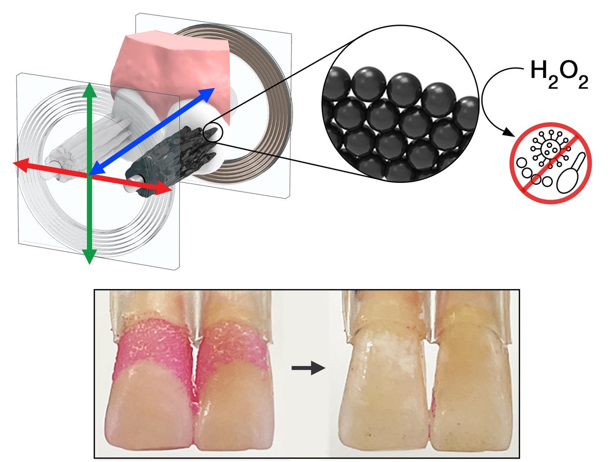 Shapeshifting microbot swarms used to brush teeth ‘hands-free’ by scientists