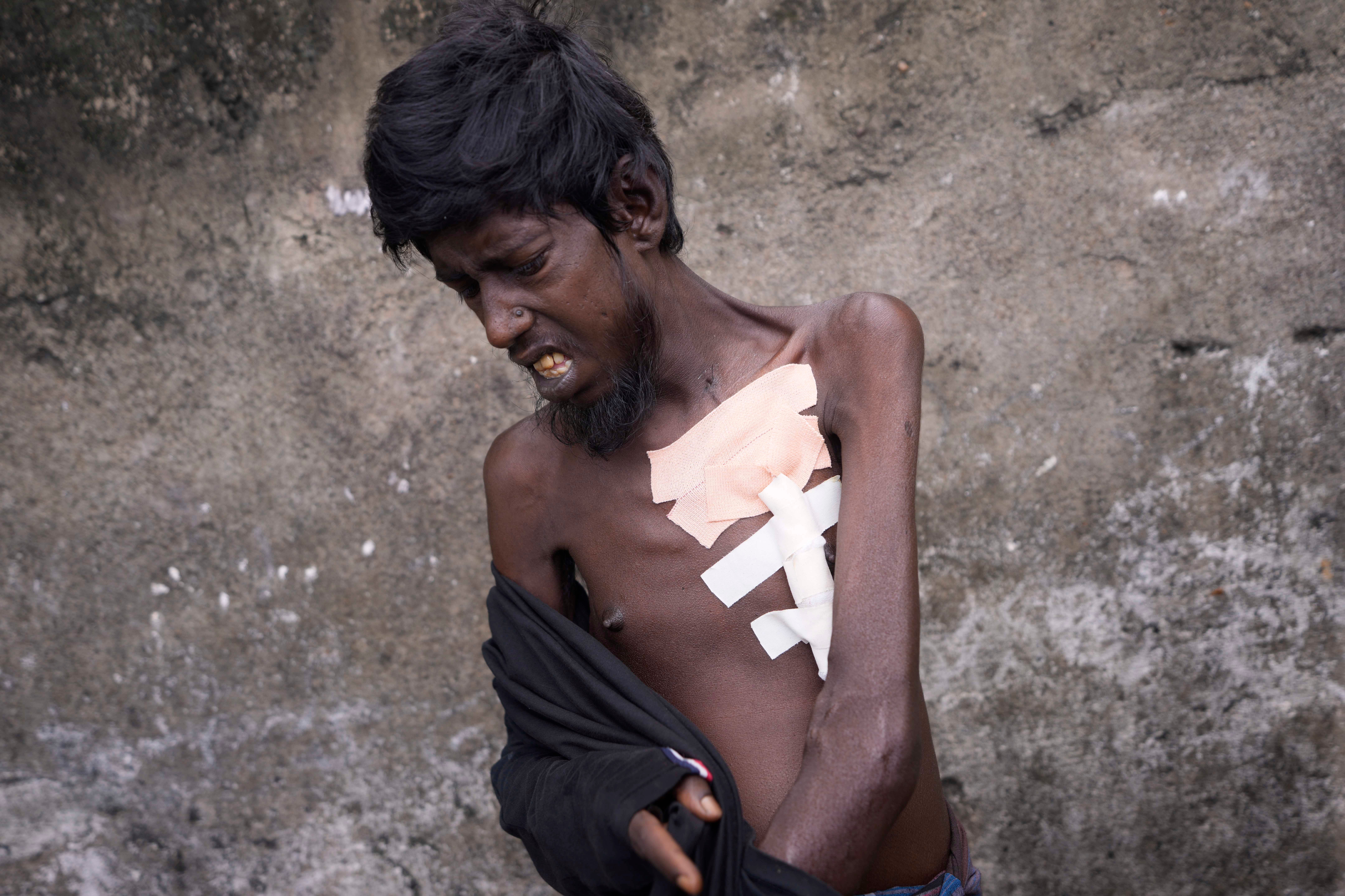 APTOPIX Sri Lanka Health Crisis