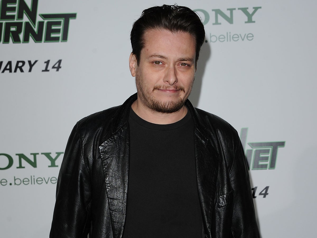 Former child star Edward Furlong reveals new teeth after meth and heroin addiction