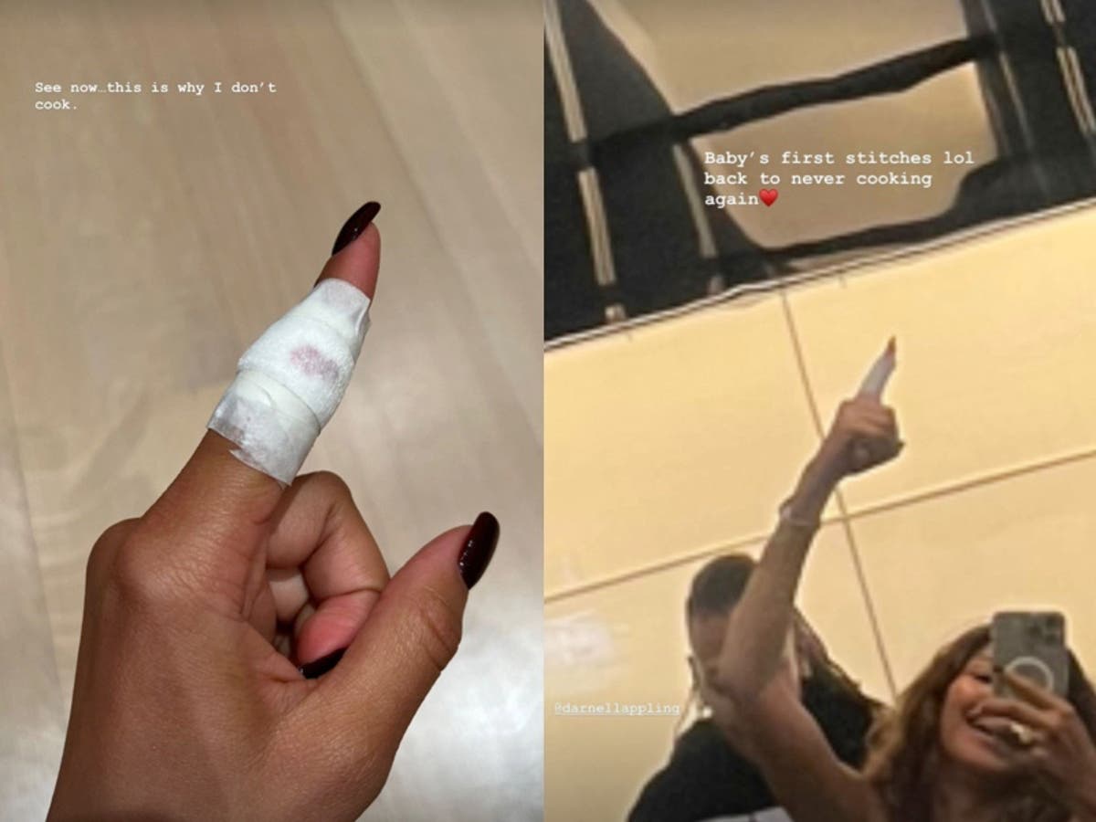 Zendaya gets stitches after injuring finger in cooking accident: ‘This is why I don’t cook’ Zendaya gets stitches after injuring finger in cooking accident: ‘This is why I don’t cook’