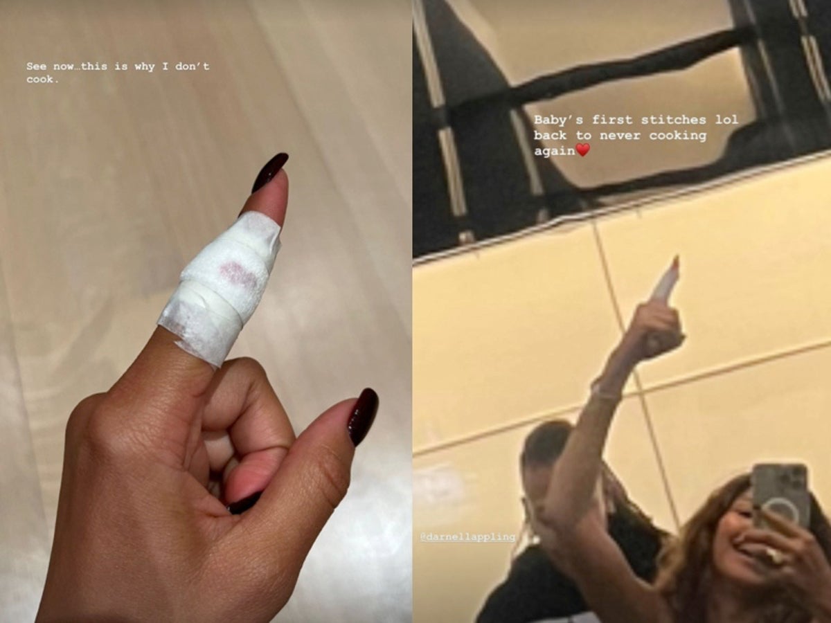 Zendaya gets stitches after injuring finger in cooking accident: ‘This is why I don’t cook’
