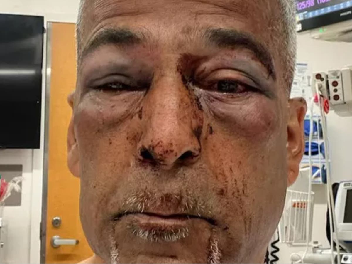 Charity leader beaten by two homeless men with plank after asking them to leave community centre doorstep