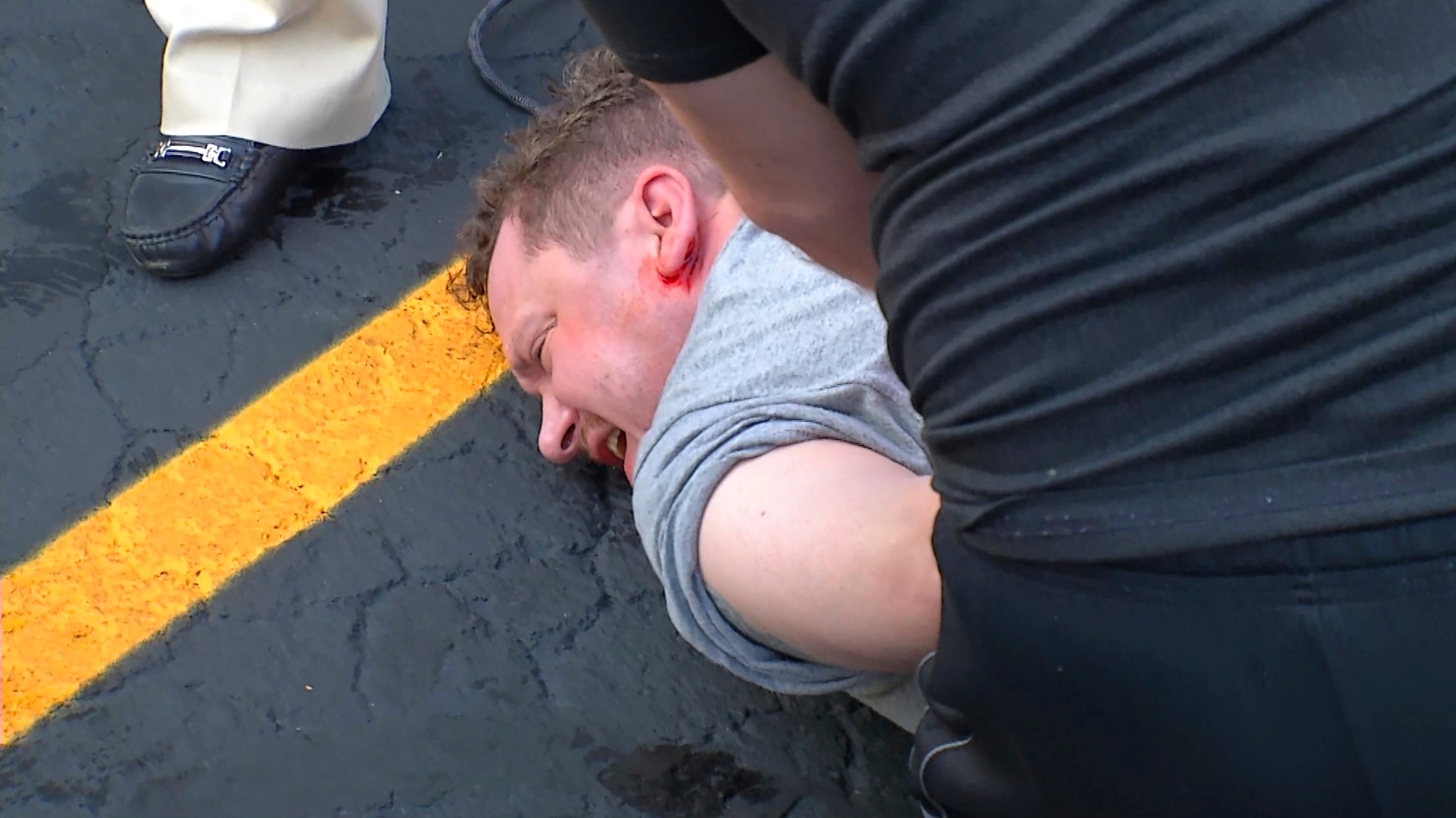 Election 2022 New York Governor Zeldin Attacked