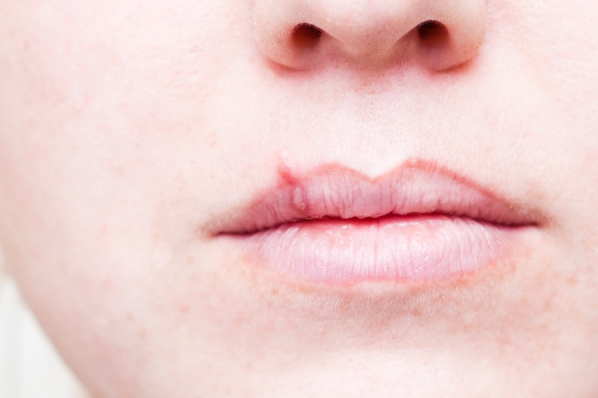 https://static.independent.co.uk/2022/07/27/19/iStock-185284088.jpg?width=1200&height=800&crop=1200:800