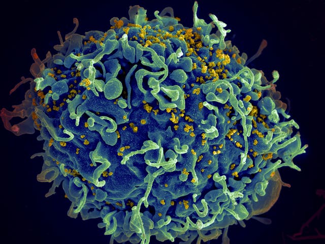 HIV-Stalled Progress