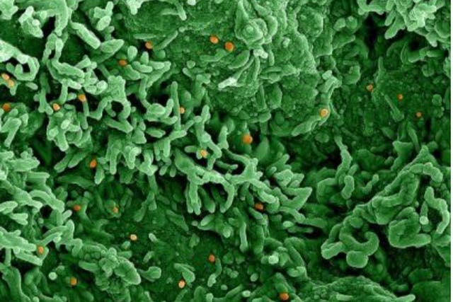 <p>Infection threat: Colorised scanning electron micrograph of monkeypox virus (orange) on the surface of infected Vero E6 cells (green).</p>