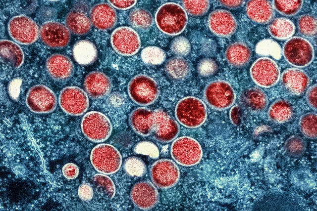 <p>A colorized transmission electron micrograph of monkeypox particles (red) found within an infected cell (blue)</p>