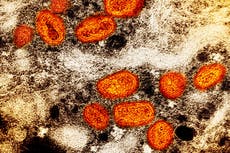 If monkeypox spreads through sexual contact, is it an STD?