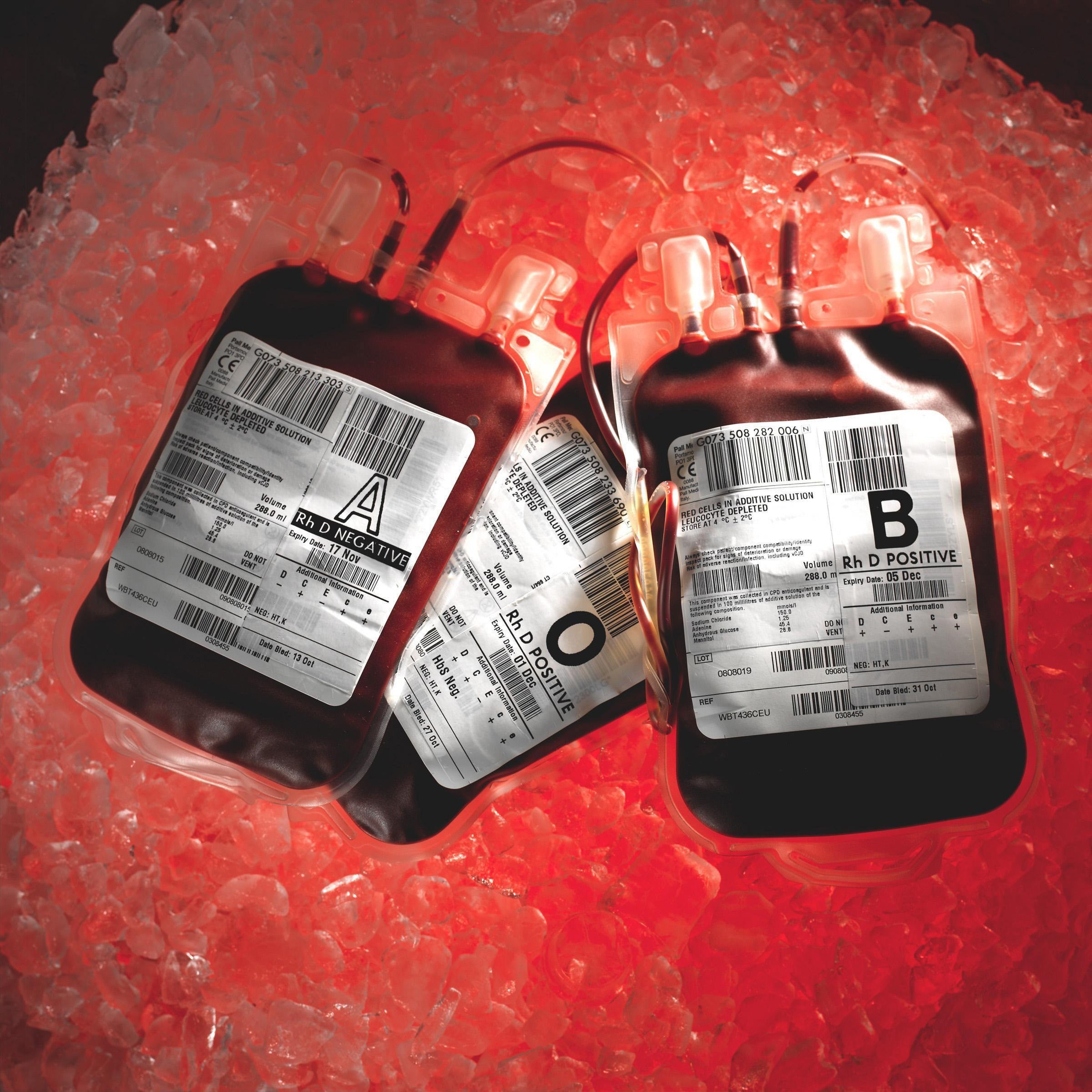 Undated NHS Blood and Transplant handout photo of blood bags. Thousands of patients are to be recalled for tests to see if they have been infected with blood-borne viruses which could include HIV. The recall has been sparked amid concerns over a dentist who treated patients in Nottingham over a 32-year period.