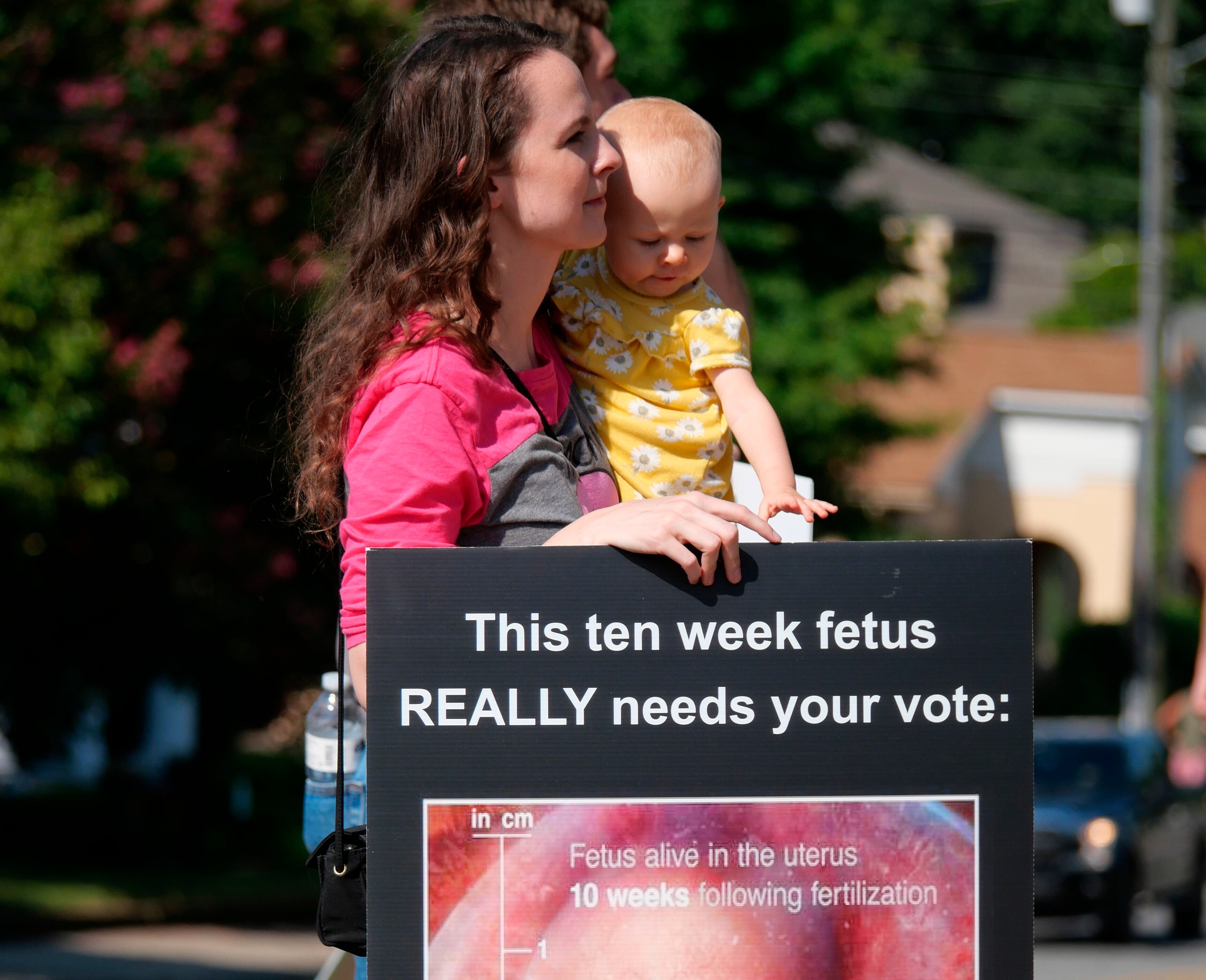 Abortion Explainer Personhood