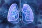 AI lung disease test to be rolled out in GP surgeries