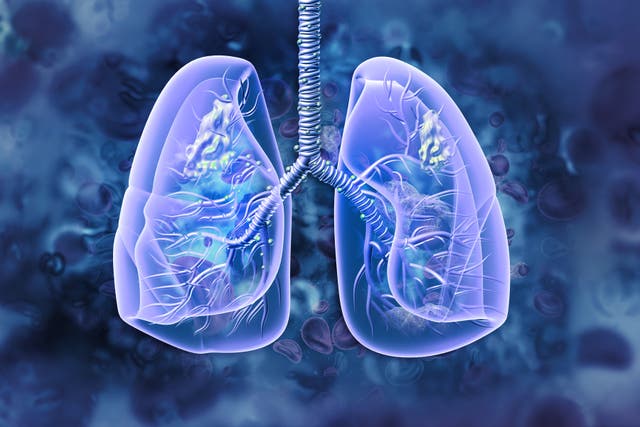 <p> The findings could help develop new treatments for non-smokers diagnosed with lung cancer   </p>