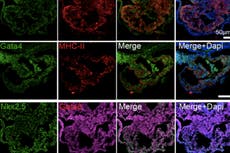 Synthetic mouse embryos with brains and beating hearts grown using only skin cells