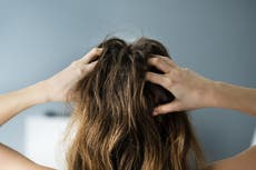 Hair expert warns against viral anti-dandruff TikTok trend that could ‘cause chemical burn’