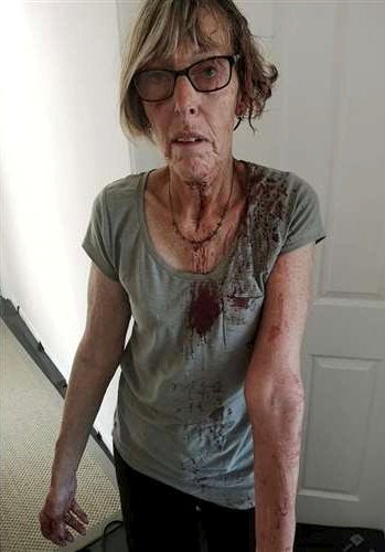 <p>Brenda Thrumble was left covered in blood after the attack </p>