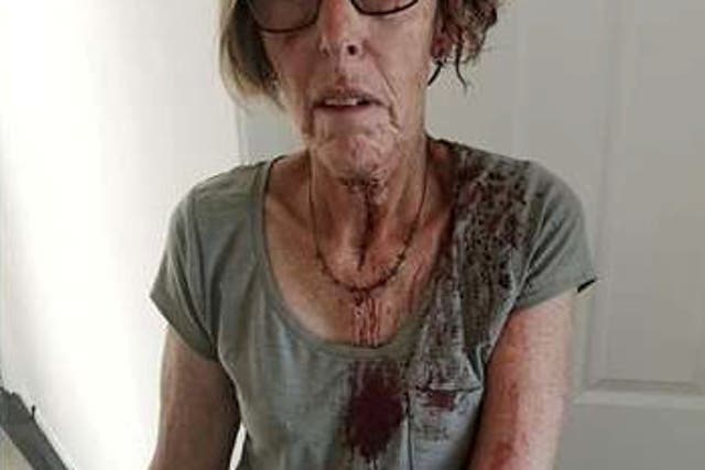 <p>Brenda Thrumble was left covered in blood after the attack </p>
