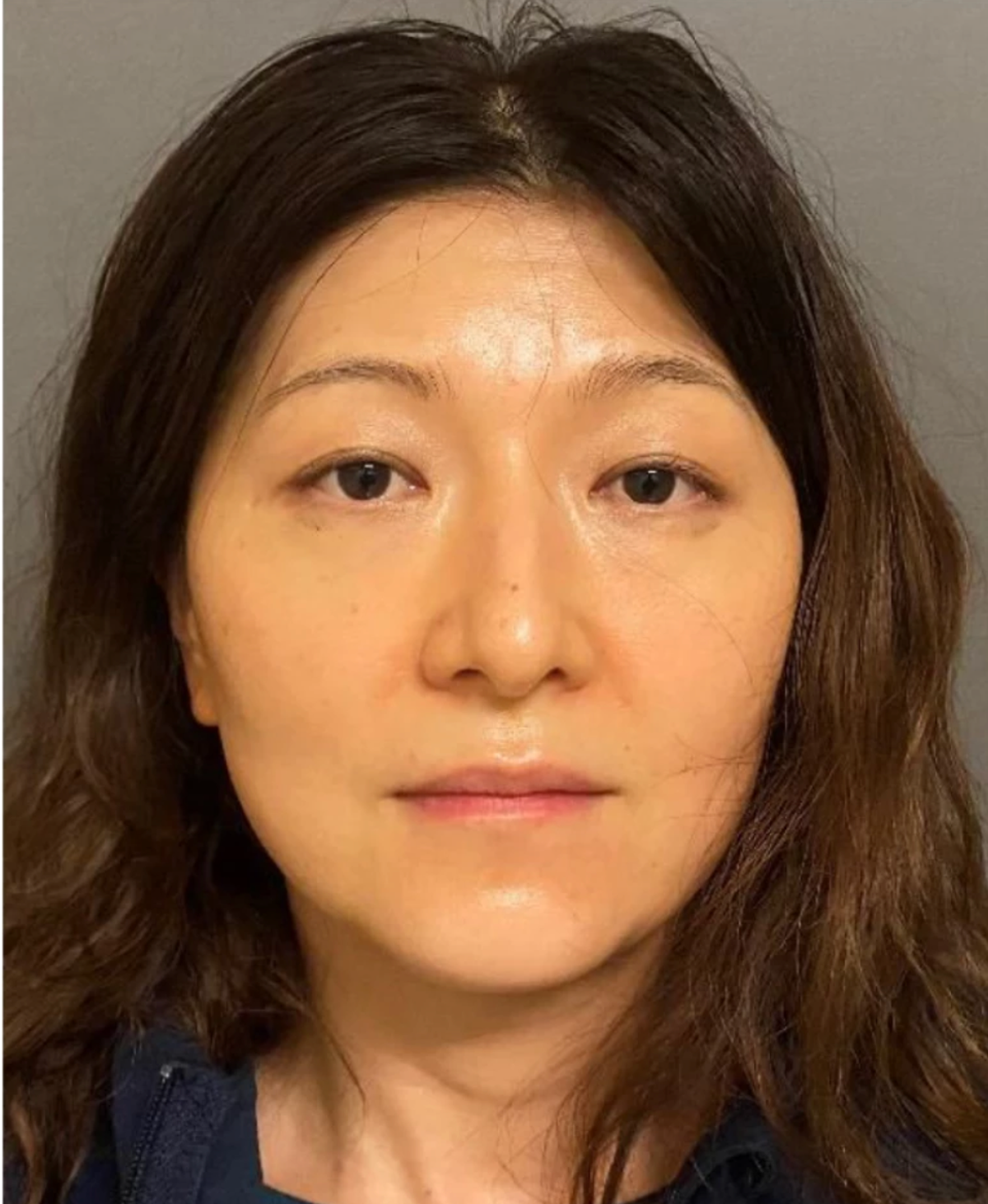 California dermatologist accused of poisoning husband who has been sick for a month California dermatologist accused of poisoning husband who has been sick for a month