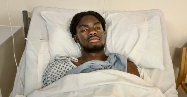 <p>Billie Busari will need a metal plate inserted into his jaw after it was broken in the attack </p>