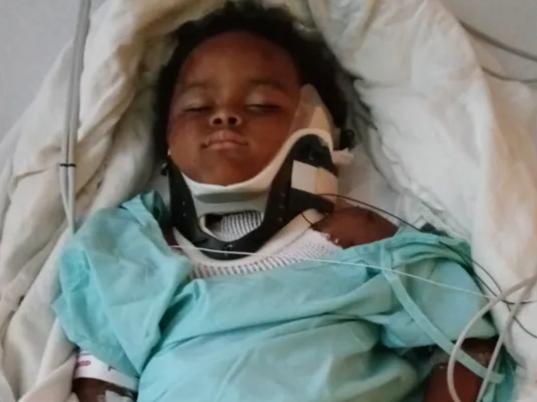 An image shared on GoFundMe by the family of Carson, 4, who was attacked by a pit bull