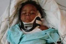 Teen babysitter saves baby mauled by pit bull