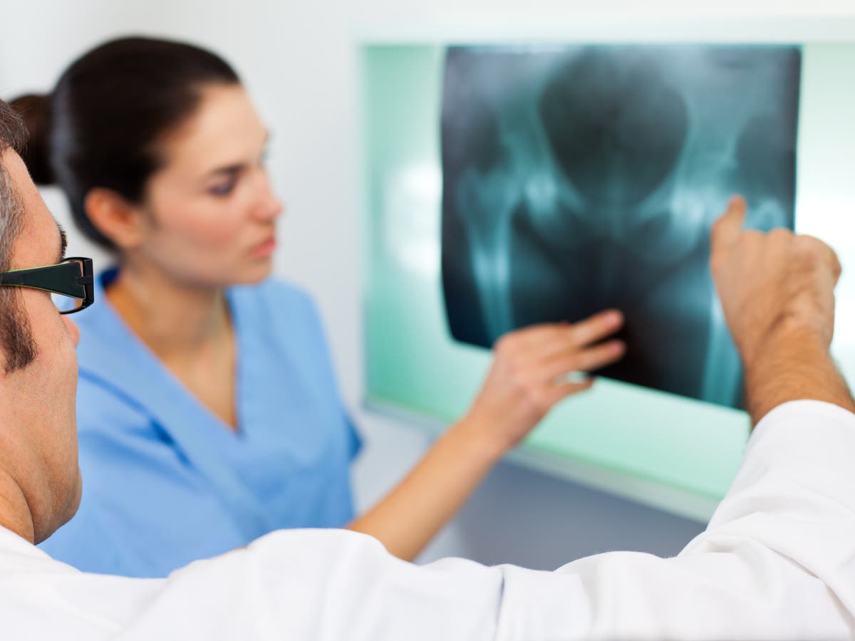 Vegetarian women are &lsquo;more likely to break hips&rsquo;, study finds