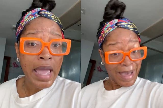 <p>Keke Palmer jokingly calls out plastic surgeons for not being able to find solution for adult acne</p>