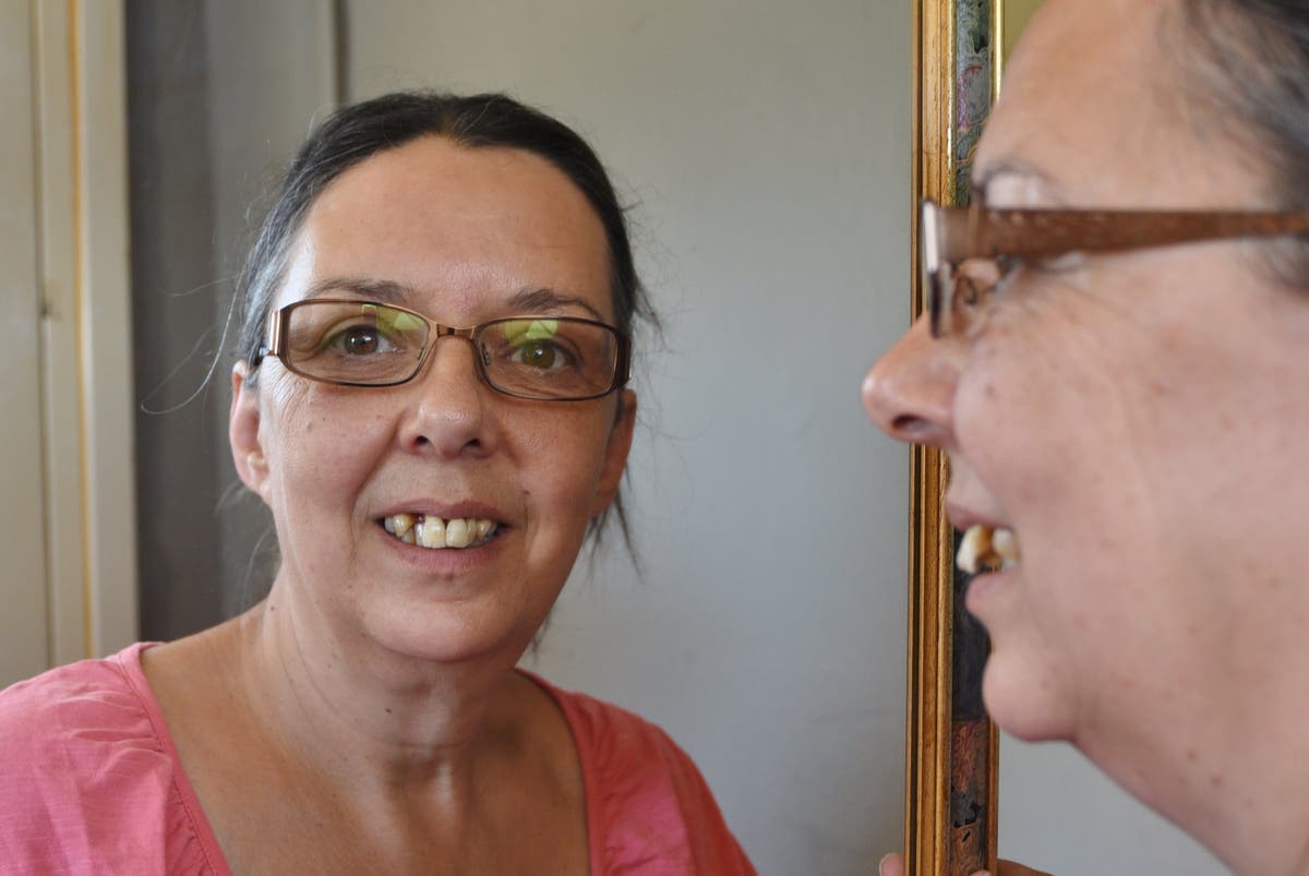 ‘A nightmare’: Desperate mother pulls her own teeth out three times after failing to get dentist appointment ‘A nightmare’: Desperate mother pulls her own teeth out three times after failing to get dentist appointment