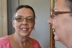 ‘A nightmare’: Desperate mother pulls her own teeth out three times after failing to get dentist appointment