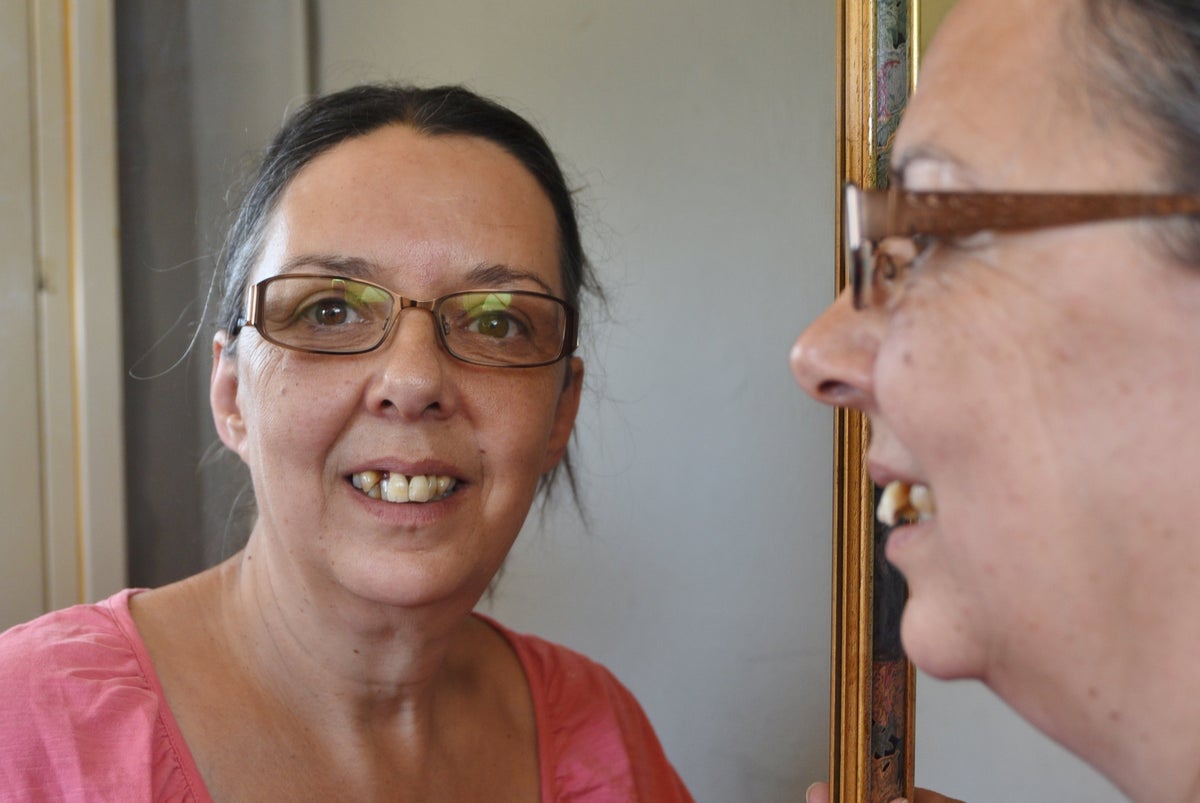 ‘A nightmare’: Desperate mother pulls her own teeth out three times after failing to get dentist appointment